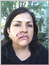Letter Carrier victim of dog attack