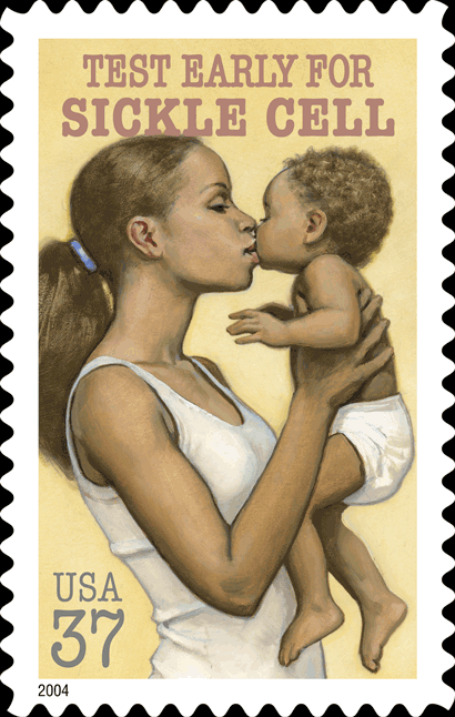 Stamp Announcement 04-28. Sickle Cell Disease Awareness Stamp, copyright 2003.